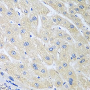 Polyclonal Rabbit anti-Human PON1 / ESA Antibody (IHC, WB)