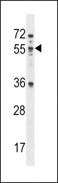MEX3B / RKHD3 Antibody (aa37-65)