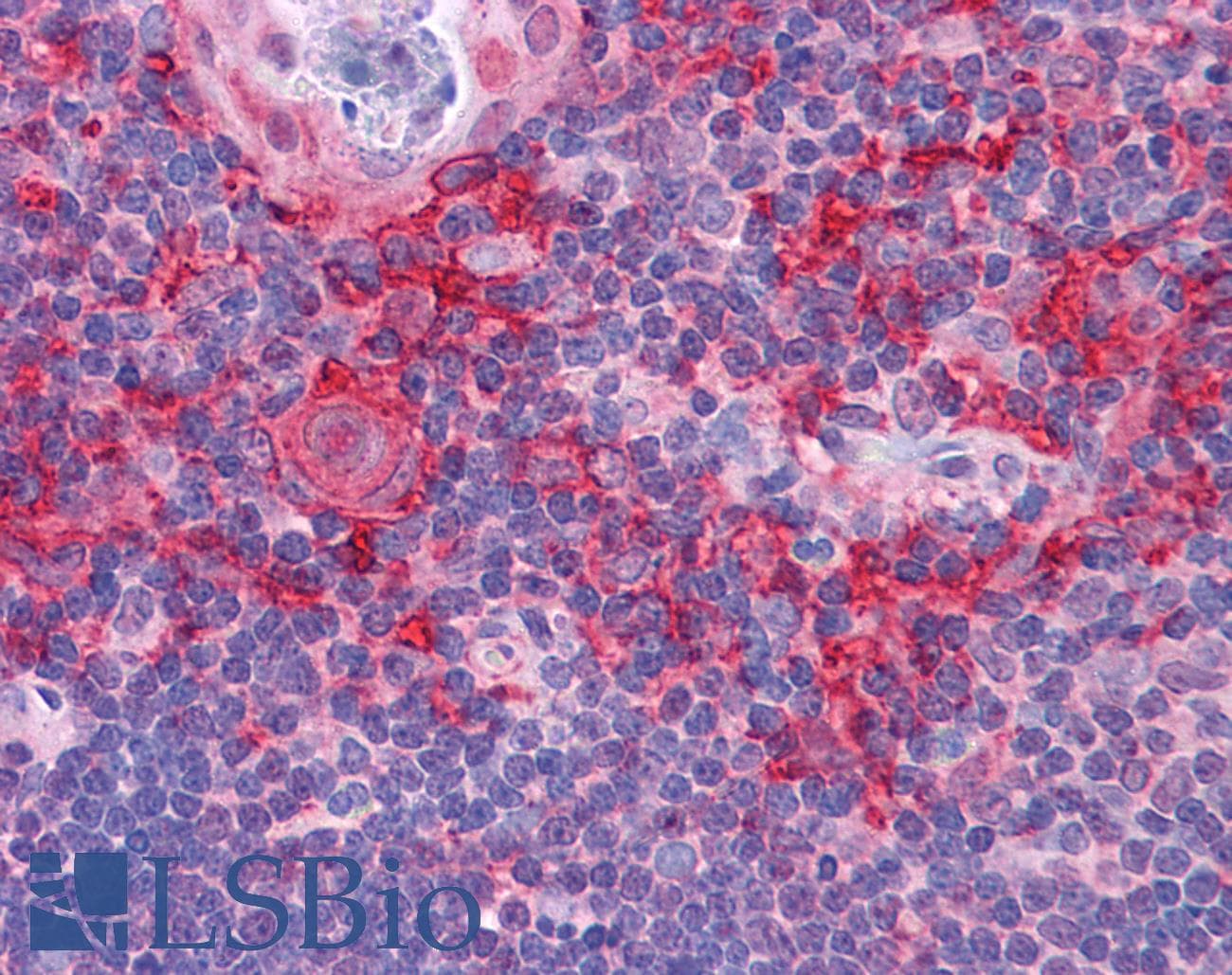 IHC-plus™ Polyclonal Chicken anti-Human KLHL25 Antibody (IHC, IF, WB)
