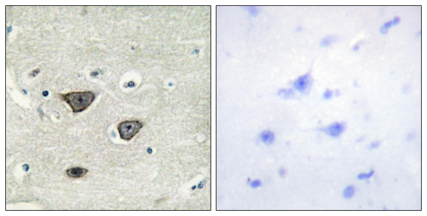 CDH8 / Cadherin 8 Antibody