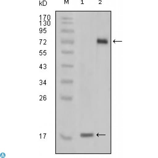 Monoclonal Mouse anti-Human STYK1 Antibody (IHC, WB)