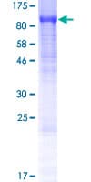 Human TRAPPC11 Protein (Recombinant GST)