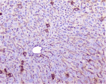 TNFRSF1A / TNFR1 Antibody
