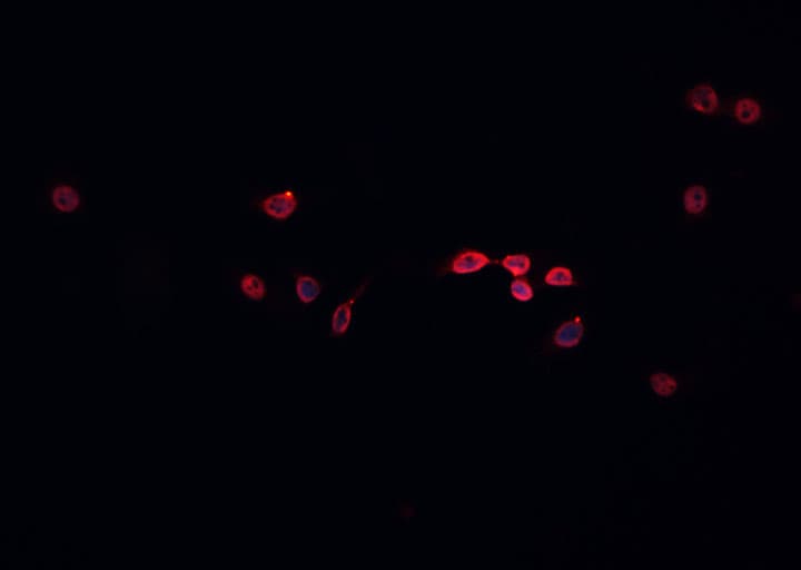Polyclonal Rabbit anti-Human MCM5 Antibody (IHC, IF, WB)