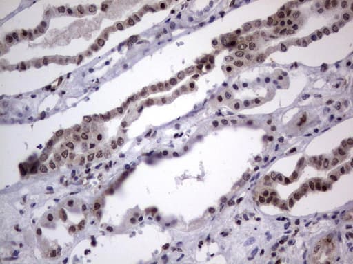 Monoclonal Mouse anti-Human DDX56 Antibody (clone UMAB152, Carrier-free, aa323-547, IHC, IF, WB)