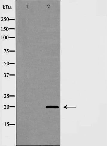 CAV1 / Caveolin 1 Antibody
