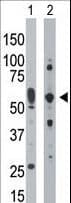 EIF2AK2 / PKR Antibody (aa519-550)