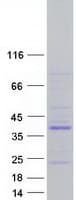 Human PTPN20 Protein (Recombinant Myc-DDK (Flag))