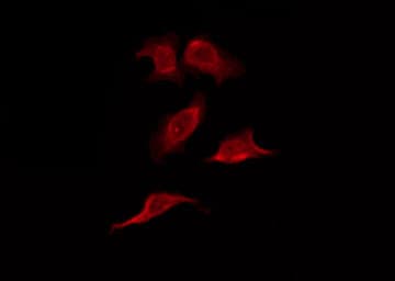 Polyclonal Rabbit anti-Human OR6C2 Antibody (IF, WB)