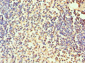 Polyclonal Rabbit anti-Human CA1 / Carbonic Anhydrase I Antibody (aa1-261, IHC, WB)