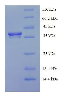 Human HEBP2 Protein (Recombinant His-SUMO)