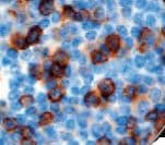 Monoclonal Mouse anti-Human SPN / CD43 Antibody (clone MT1, Ready-to-Use, IHC)