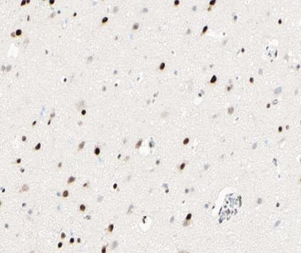 EP300 / p300 Antibody