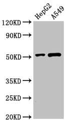 Polyclonal Rabbit anti-Human PNLIPRP2 Antibody (IHC, WB)