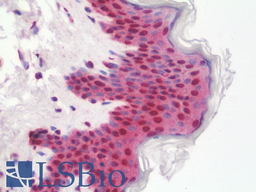IHC-plus™ Polyclonal Rabbit anti-Human ETV6 / TEL Antibody (aa84-111, IHC, WB)