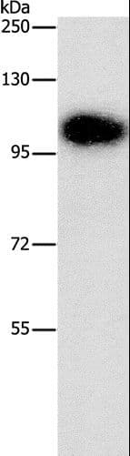 Polyclonal Rabbit anti-Human DNM3 / Dynamin 3 Antibody (WB)