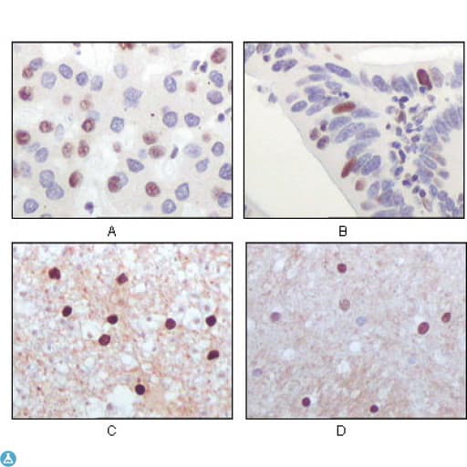 KAT5 / TIP60 Antibody