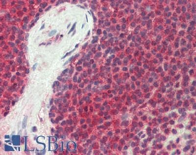 IHC-plus™ PDCD6 / ALG-2 Antibody