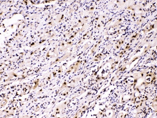 Polyclonal Rabbit anti-Human ACLY / ATP Citrate Lyase Antibody (IHC, WB)