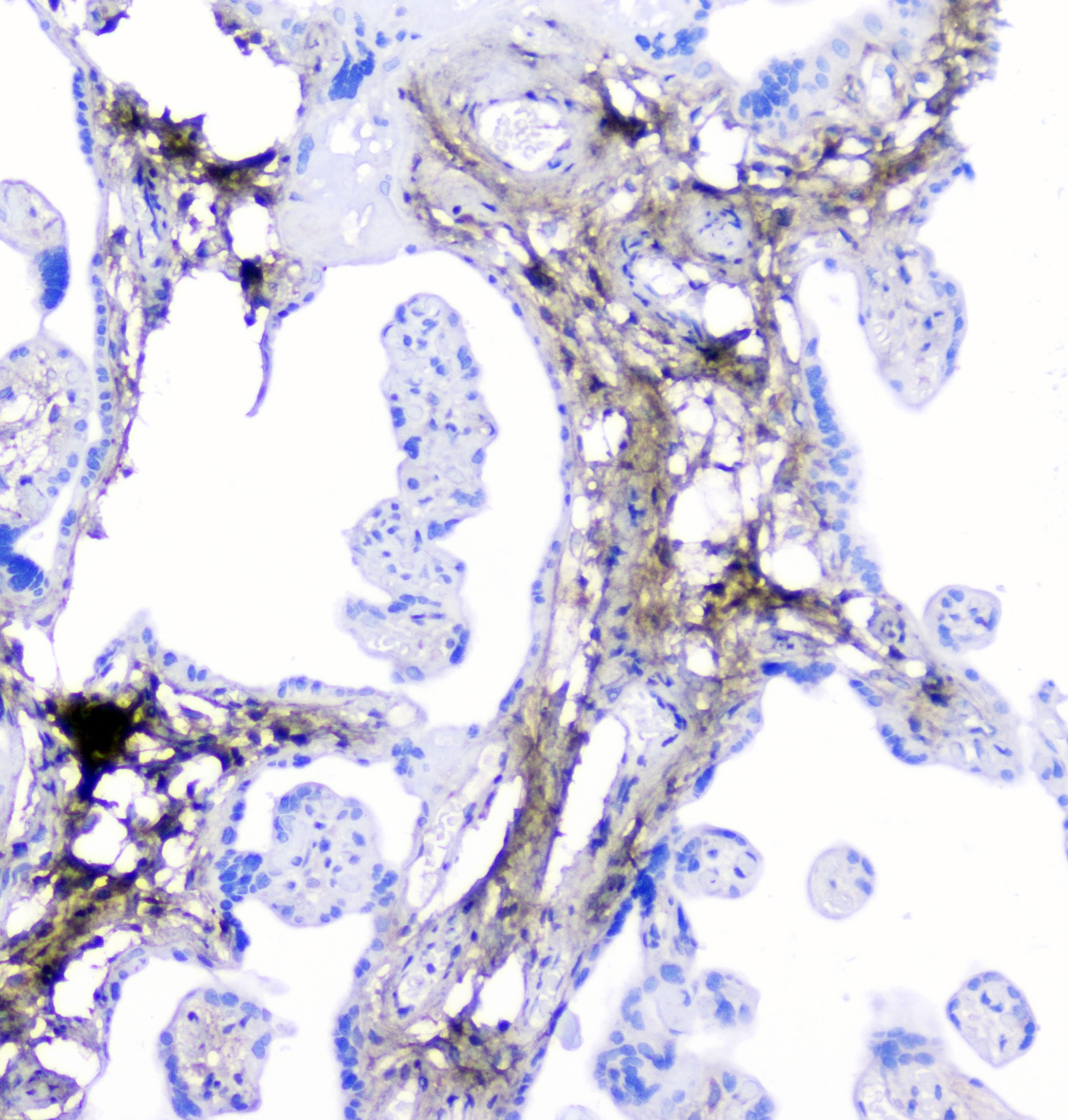 Polyclonal Rabbit anti-Human Lumican Antibody (IHC, WB)