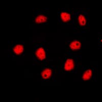GATA4 Antibody (Internal)
