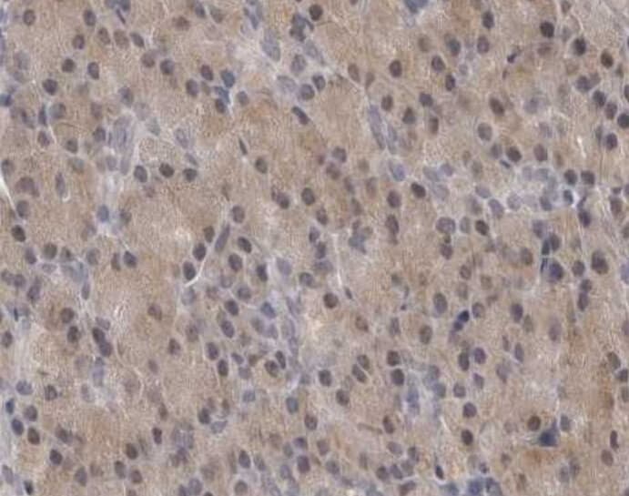 IL11 Antibody