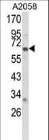 Polyclonal Rabbit anti-Human CYP2F / CYP2F1 Antibody (aa395-424, IHC, WB)