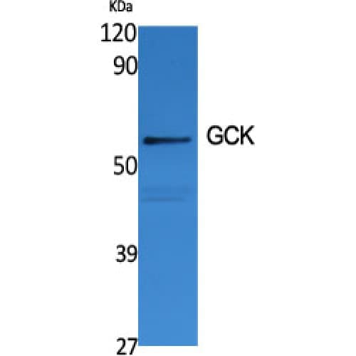 GCK / Glucokinase Antibody (N-Terminal)