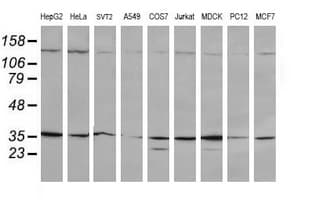 MAP2K3 / MEK3 / MKK3 Antibody (clone OTI5F2)