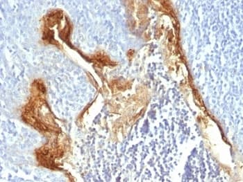 IVL / Involucrin Antibody (clone IVRN/827)