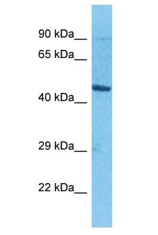 solute carrier family 35, member E2B (SLC35E2B), transcript variant 1 Antibody (aa4-53)