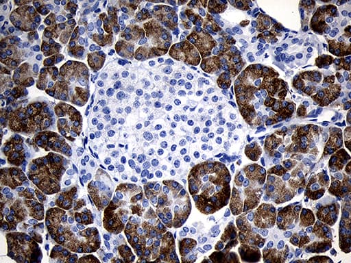 C1orf111 Antibody (clone OTI2F3)