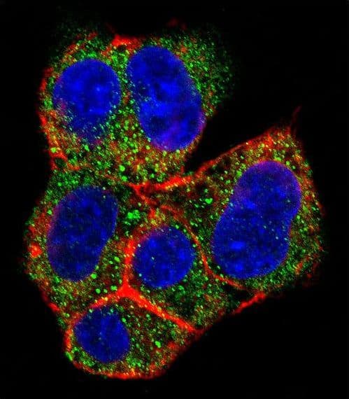 Polyclonal Rabbit anti-Human AGL Antibody (aa1479-1510, IF, WB)