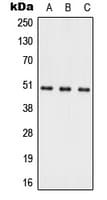 Polyclonal Rabbit anti-Human ACER1 / ASAH3 Antibody (Internal, WB)
