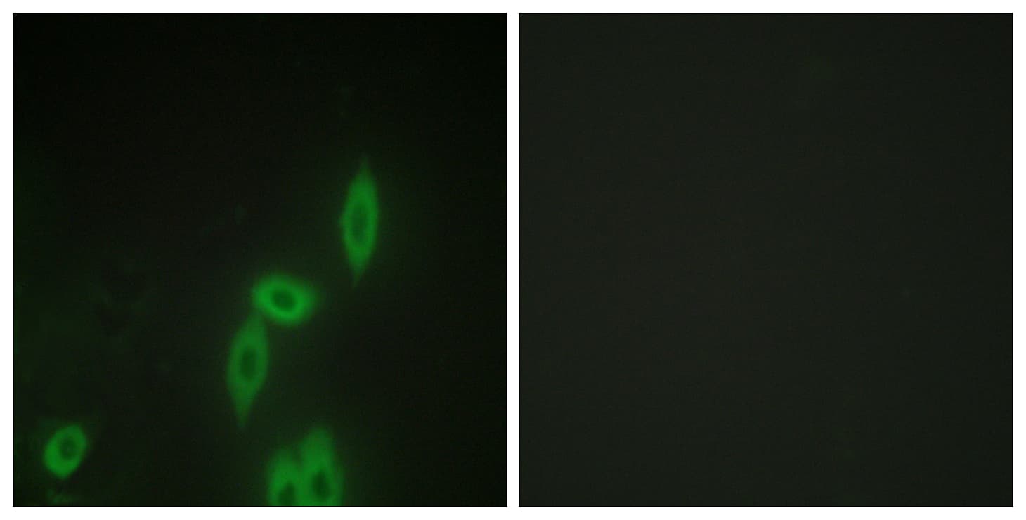 PCDH11X+Y Antibody (aa531-580)