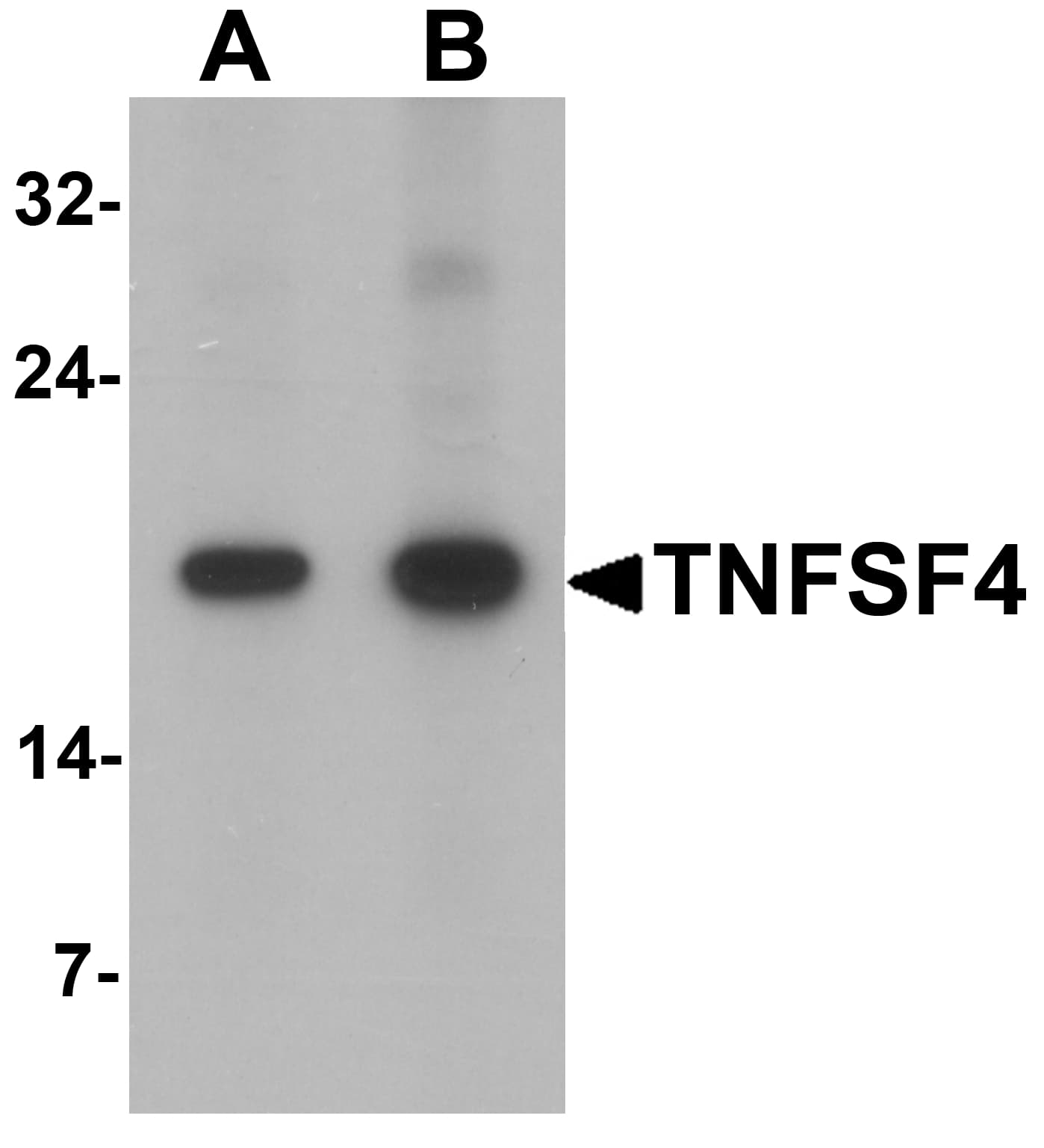 IHC-plus™ Polyclonal Rabbit anti-Human TNFSF4 / OX40L / CD252 Antibody (IHC, IF, WB)
