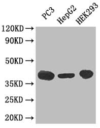 C5AR1 / CD88 / C5a Receptor Antibody