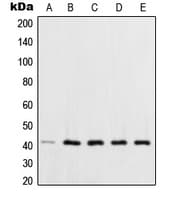 Polyclonal Rabbit anti-Human XPA Antibody (C-Terminus, IHC, WB)