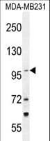 TTC16 Antibody (aa1-30)