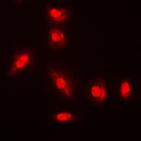 AKT1 + AKT2 + AKT3 Antibody (phospho-Tyr315)