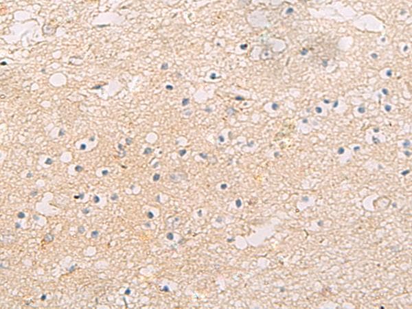 FYCO1 Antibody