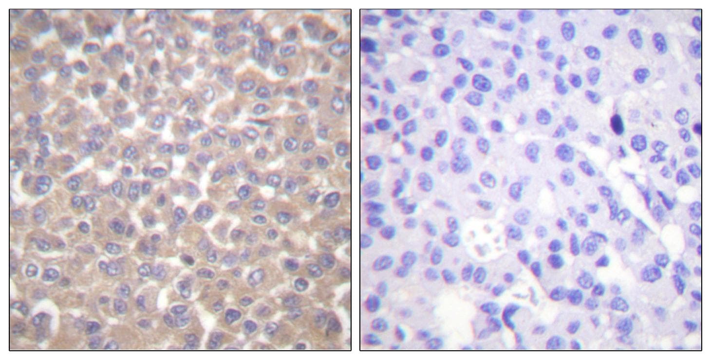 TRADD Antibody