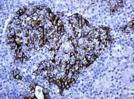 ABCB1 / MDR1 / P Glycoprotein Antibody (aa995-1280, clone 6H2, Carrier-free)