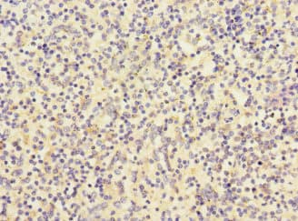 RP105 / CD180 Antibody