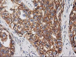 CTNNB1 / Beta Catenin Antibody (clone OTI1B11)