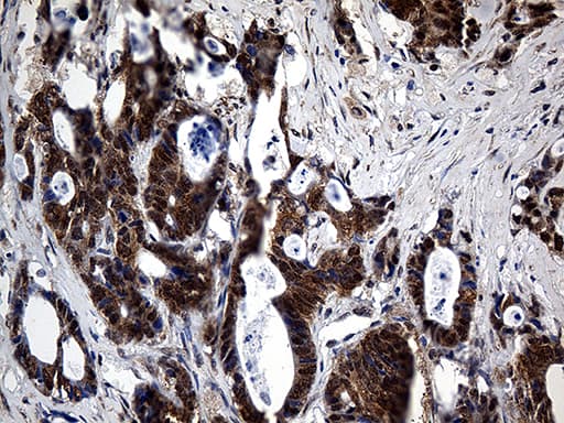 Monoclonal Mouse anti-Human UBA3 / UBE1C Antibody (clone OTI7H6, aa1-463, IHC, WB)