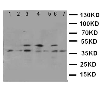 Polyclonal Rabbit anti-Human KLK11 / Kallikrein 11 Antibody (aa233-250, IHC, WB)