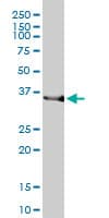 HMOX2 / Heme Oxygenase 2 Antibody (clone 1D8-1A8)