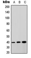 GPRC5A / RAI3 Antibody (Internal)