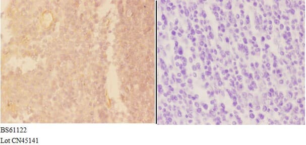 ADAMDEC1 Antibody